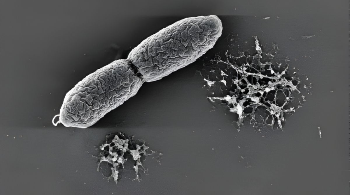Nanopartículas em interação com a bactéria Pseudomonas aeruginosa. As nanopartículas contendo o fago em processo de degradação e liberação dos bacteriófagos (estruturas menores e mais esbranquiçadas). (Foto: Arquivo/Grupo de pesquisa)